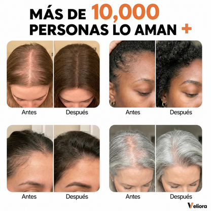 Veliora™ Sérum Capilar Coreano