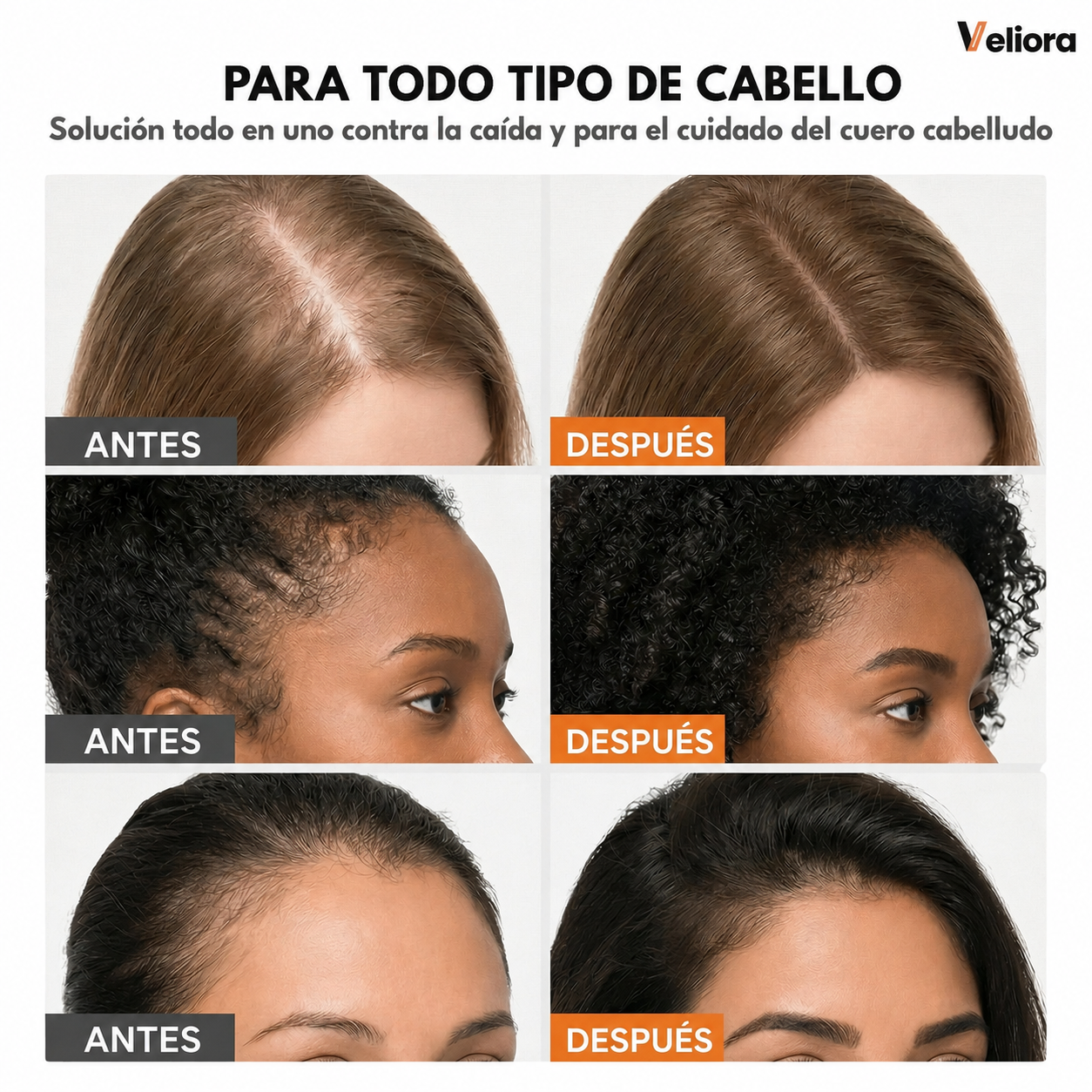 Veliora™ Sérum Capilar Coreano